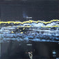Gilla Band : Pugnello (LP, Album, Dlx, Ltd)
